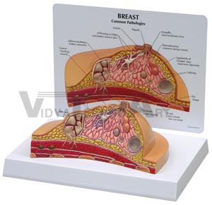 Breast Cross Section